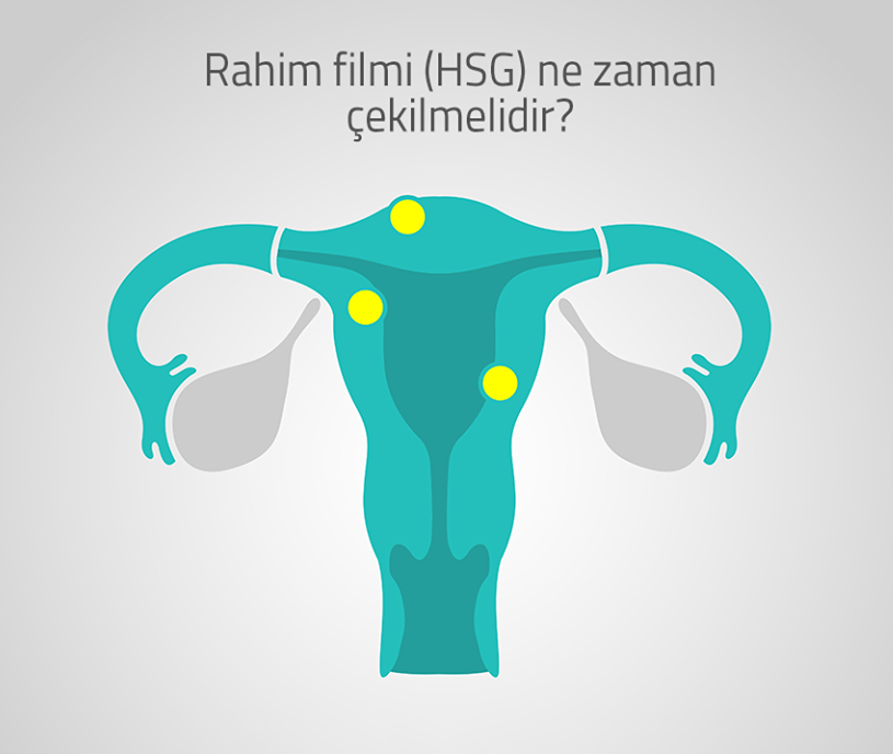 HSG Filmi Ne Zaman Çekilir?